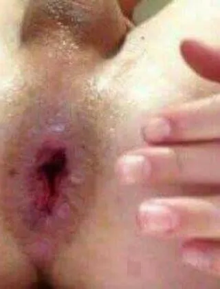 3456329300 - Fisting 3456329300